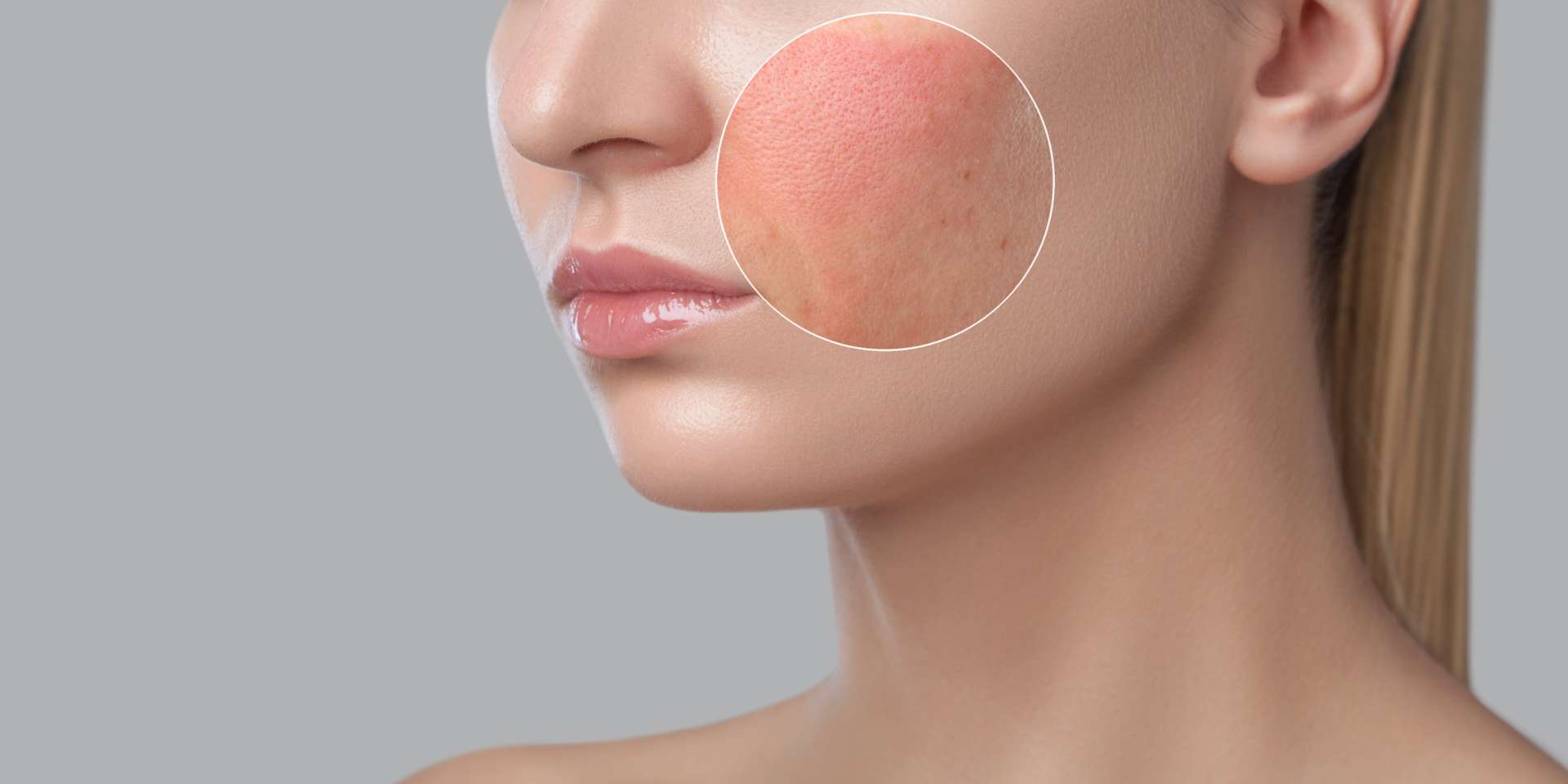 BTL Face Treatments